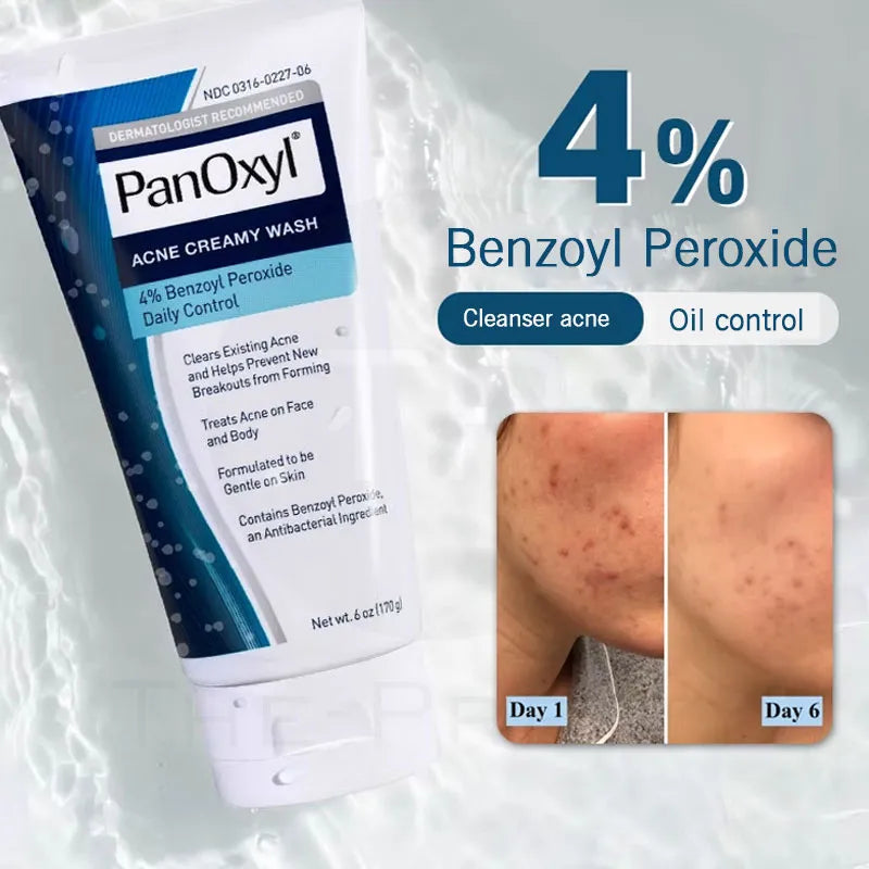 Panoxyl acne foaming wash benzoyl peroxide 4% - Buy Now Pakistan