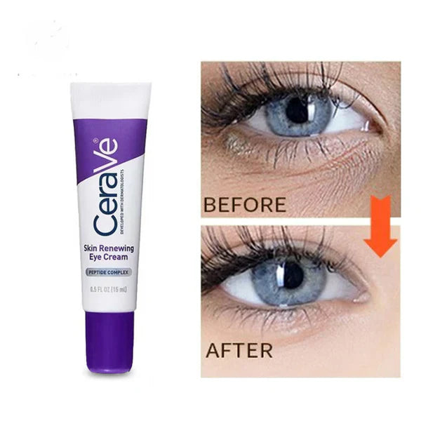 CeraVe Skin Renewing Eye Cream - Buy Now Pakistan