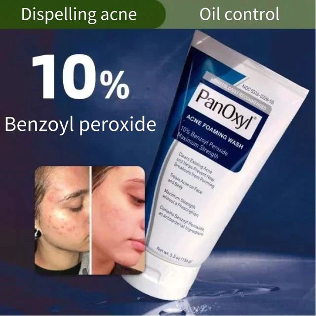 Panoxyl acne foaming wash benzoyl peroxide 10% - Buy Now Pakistan